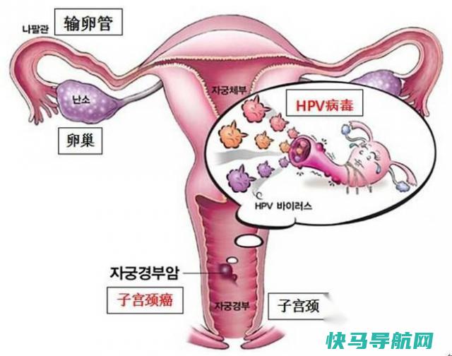 什么是癌 怎样预防癌 第2张